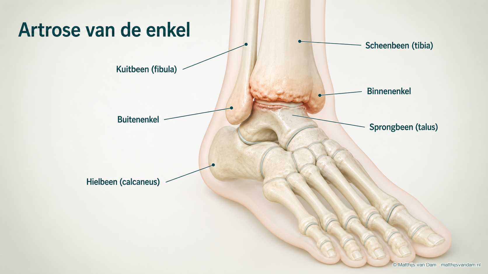 Gelabelde anatomische illustratie van het enkelgewricht met scheenbeen, kuitbeen, binnenenkel, buitenenkel, sprongbeen en hielbeen