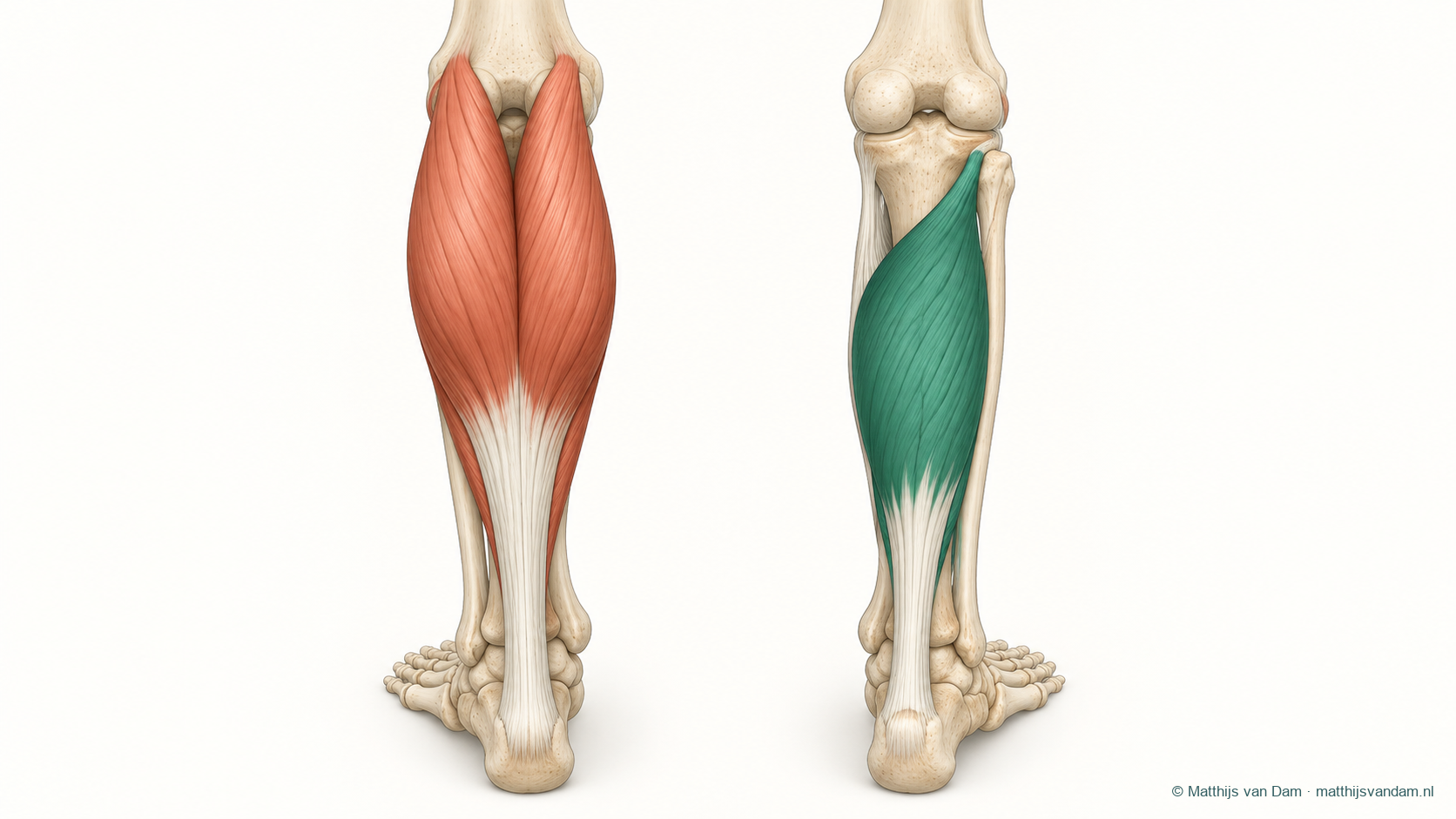 Anatomische illustratie van de oppervlakkige gastrocnemius en de dieper gelegen soleus met hun verbinding naar de achillespees